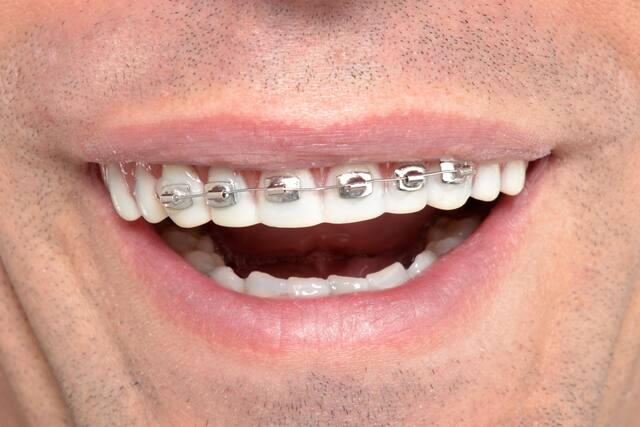 Fool-All Braces Teeth, One Size Front_Flat