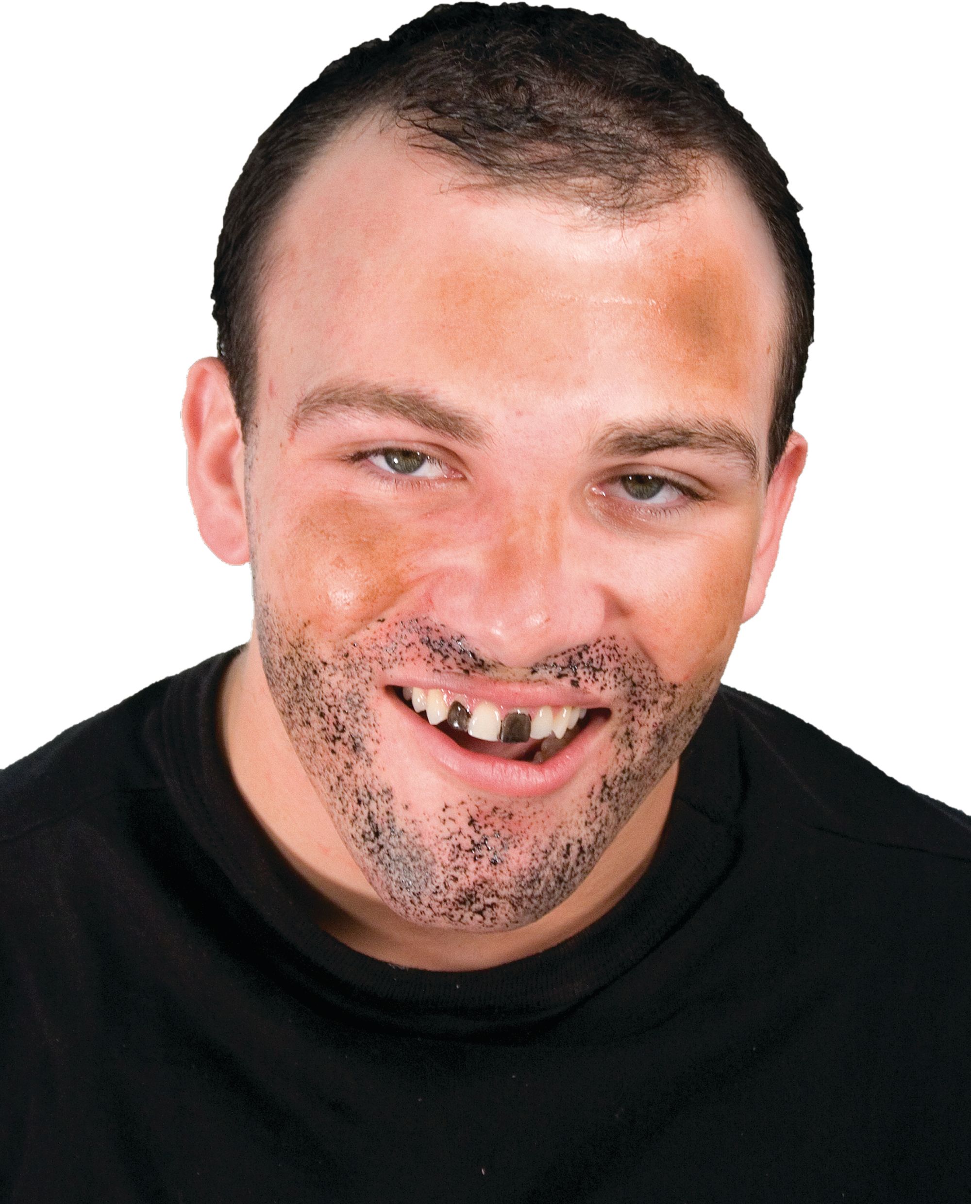 Temporary Tooth Colour Front_Flat